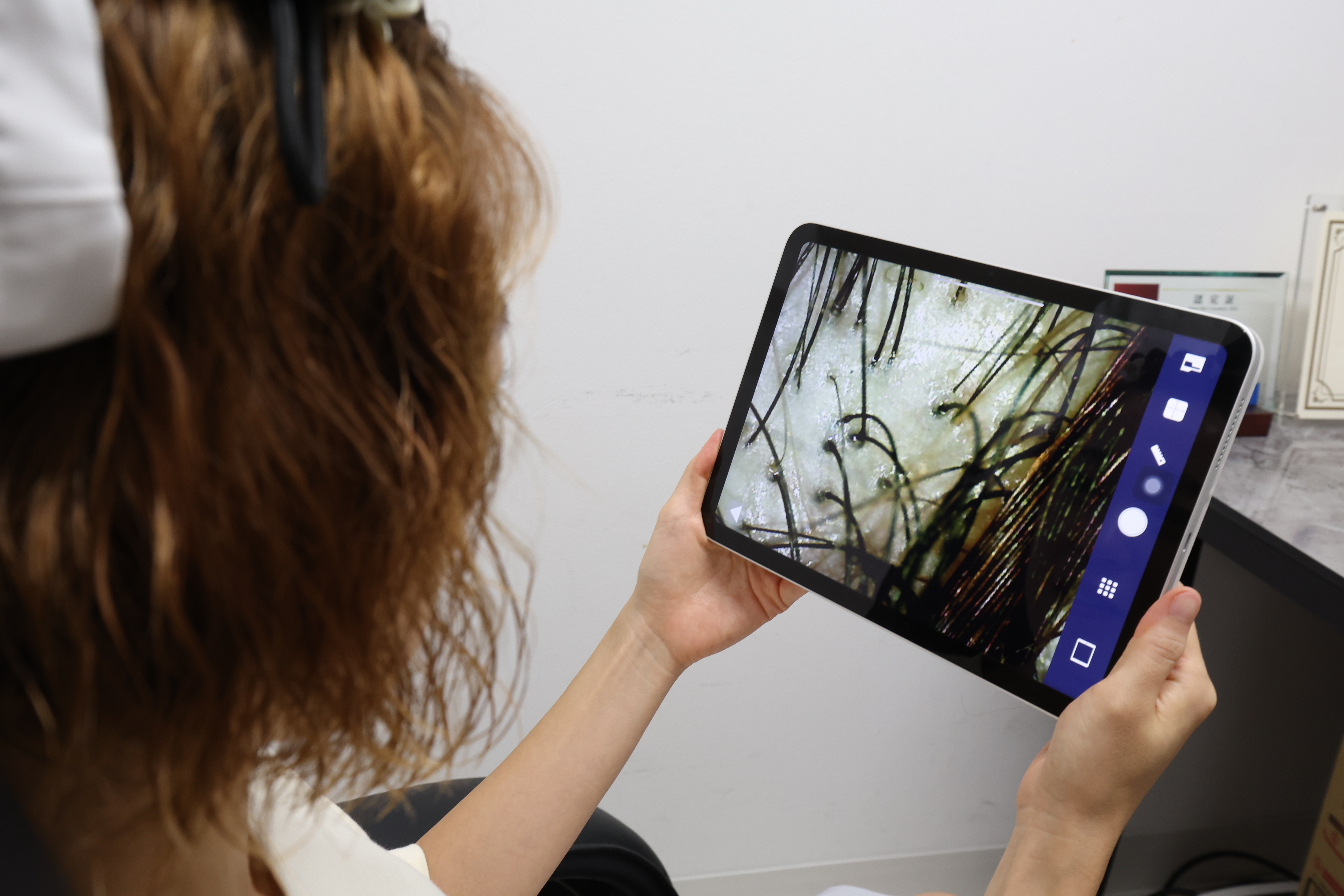 拡大した頭皮の画像をタブレットで確認している様子